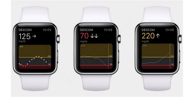 سنجش قند خون توسط ساعت هوشمند اپل و سامسونگ